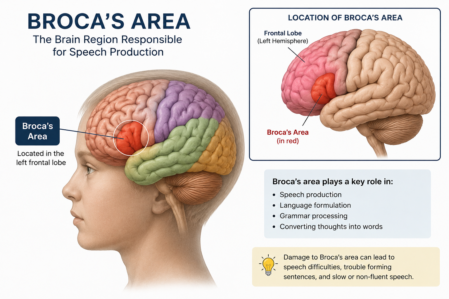 Broca Area and Autism